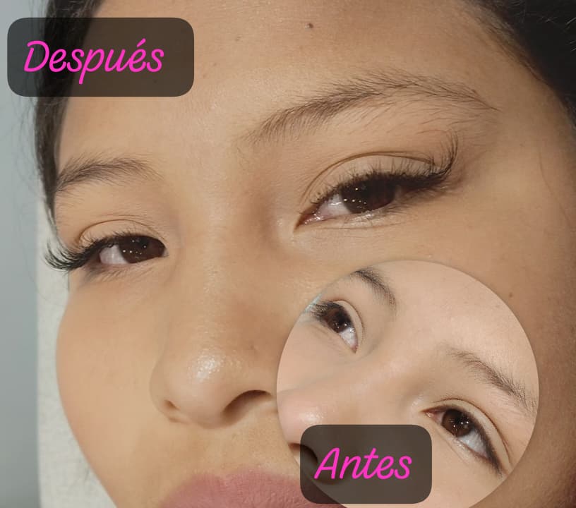 Otros 12
